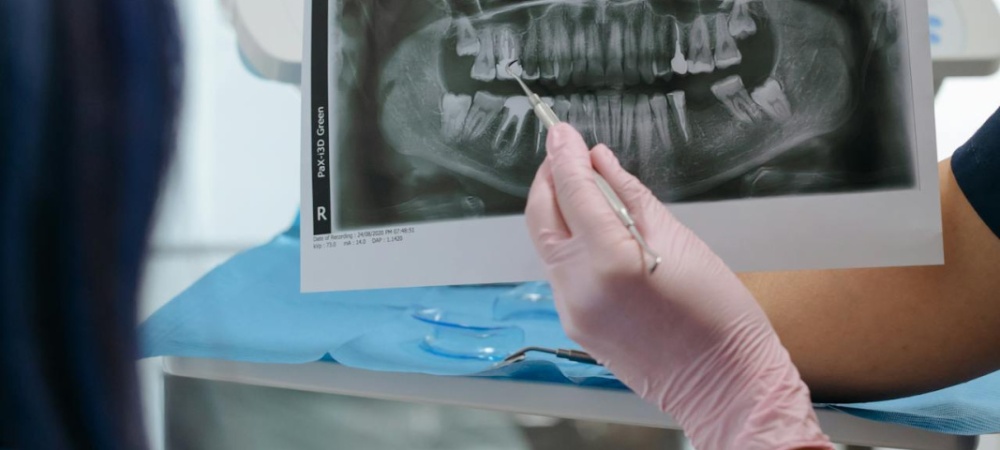 Padova endodonzia