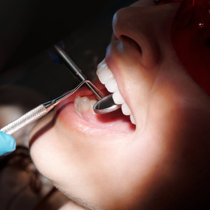odontoiatria invisibile Padova